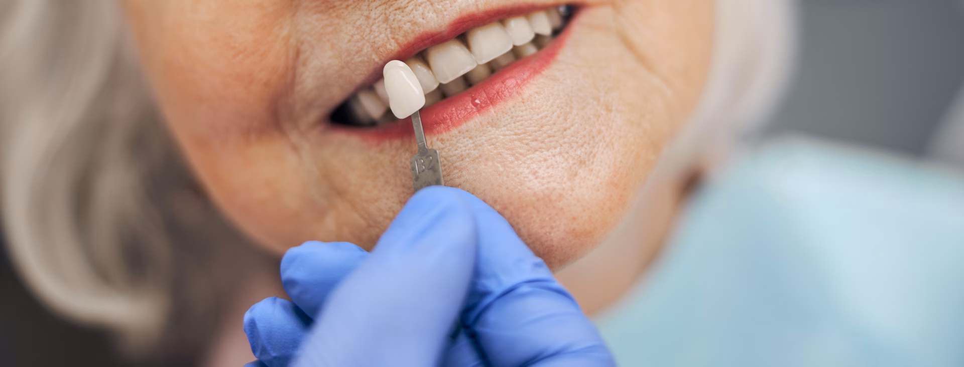 Dentist matching a tooth shade guide to a patient's smile